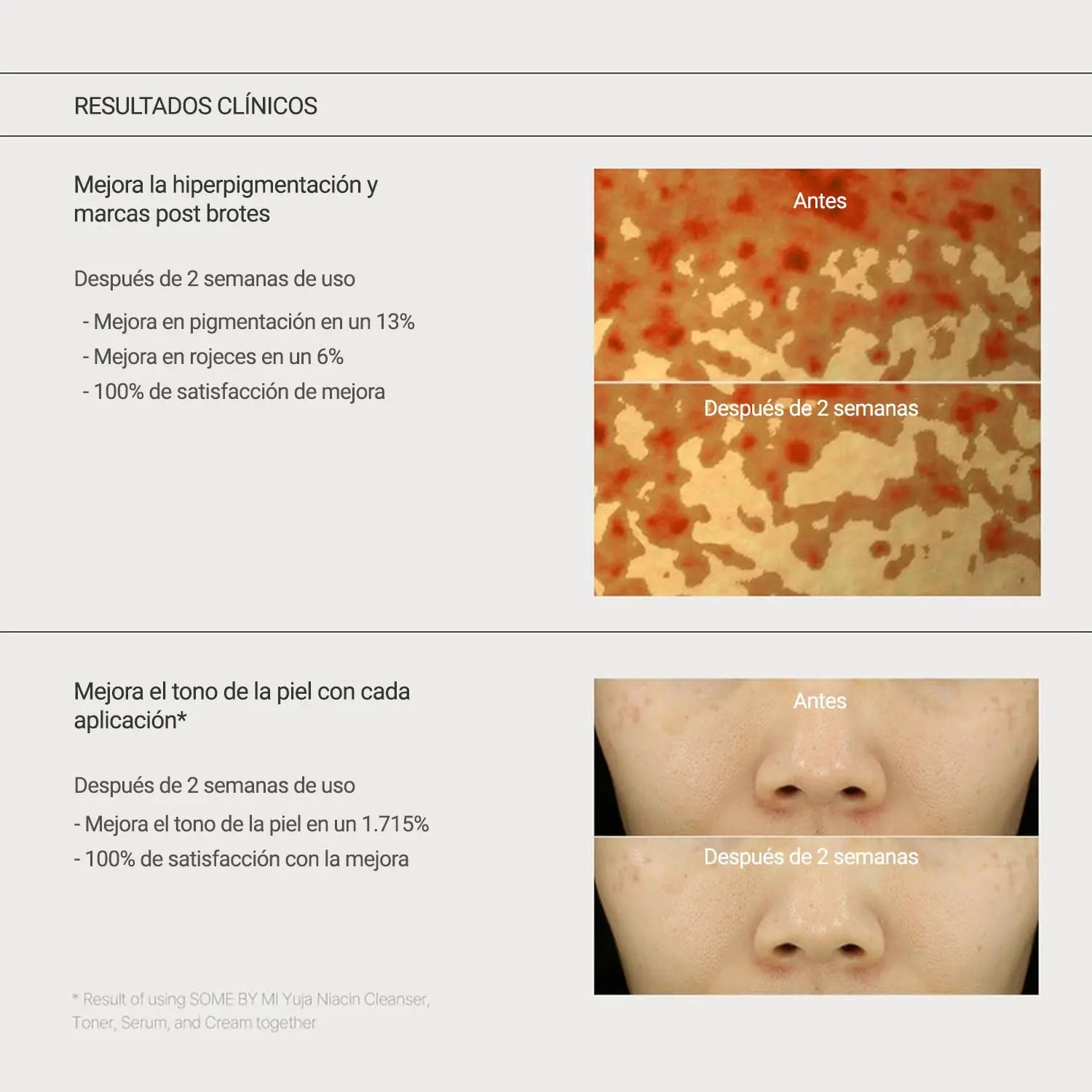 Crema anti manchas - Yuja Niacin Anti Blemish Cream SOME BY MI